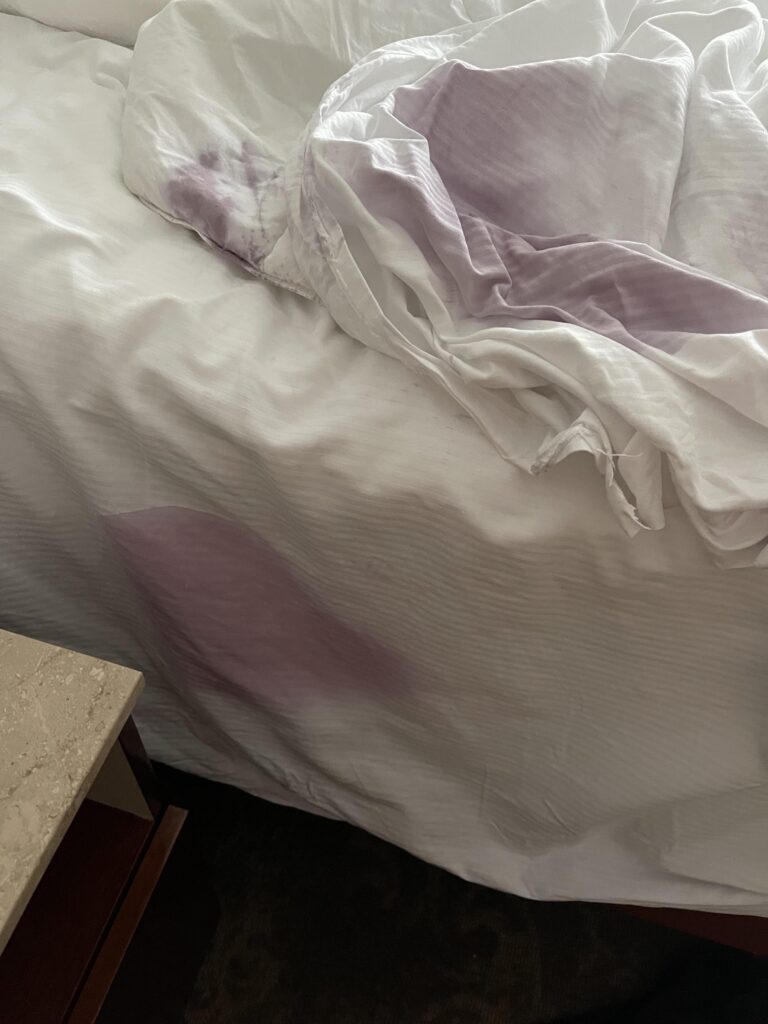 Do Hotels Charge for Stained Sheets